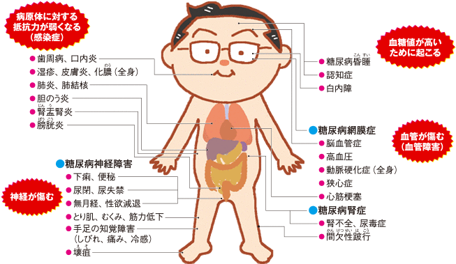 図解：全身に及ぶ糖尿病の合併症